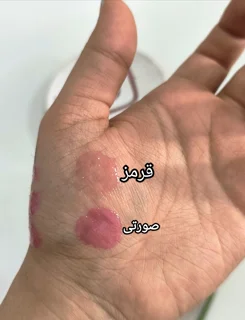 برق لب حرارتی کاریته